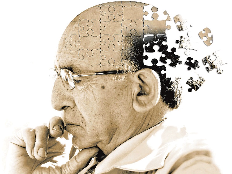 alzheimer prospettiva cure